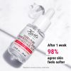 Serum ultra puro à l'acidu glicolicu à 9,8%.