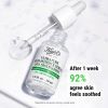 Serum ultra puro di alta potenza 5,0% niacinamide