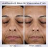 Rénergie HPN 300-Crema Peptide